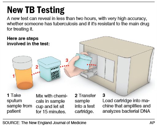 California high school to test students for tuberculosis