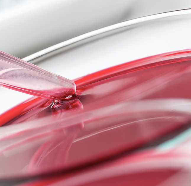 Blood Culture Contamination Leveraging IPs to Improve this Critical