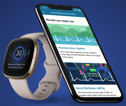 The new ECG app is available on Fitbit Sense