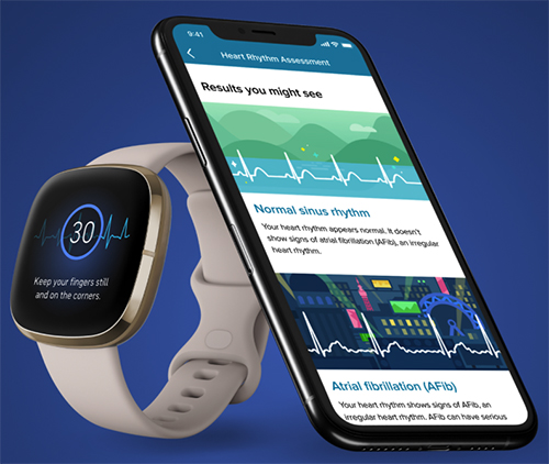 ecg app for fitbit